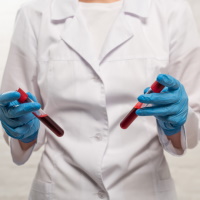 Обезличенные данные биохимических исследований крови и общего анализа крови человека должны вноситься во ФГИС сведений санитарно-эпидемиологического характера